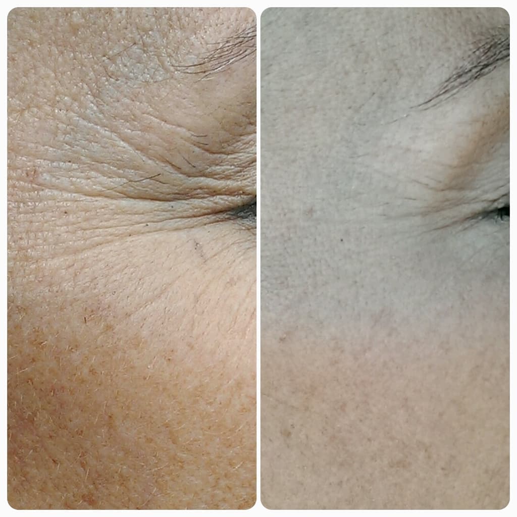 Ein Collage-Bild mit einer Nahaufnahme der Haut einer Person.